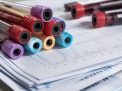 Cătălin Rizea spune că au cheltuit 15.000 de euro pe analize înainte ca Adda să primească diagnosticul de boală Lyme