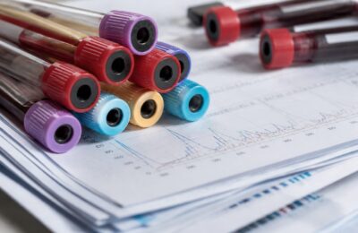 Cătălin Rizea spune că au cheltuit 15.000 de euro pe analize înainte ca Adda să primească diagnosticul de boală Lyme