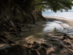 Leptospiroza, diagnosticul surpriză primit de o tânără de 18 ani după vacanța la mare