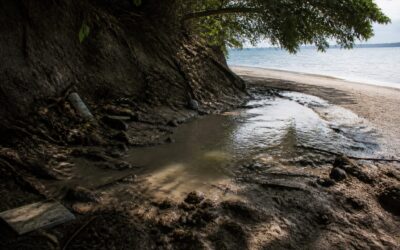 Leptospiroza, diagnosticul surpriză primit de o tânără de 18 ani după vacanța la mare