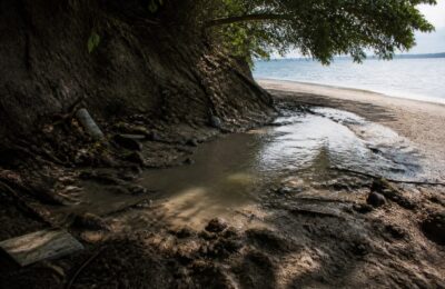 Leptospiroza, diagnosticul surpriză primit de o tânără de 18 ani după vacanța la mare