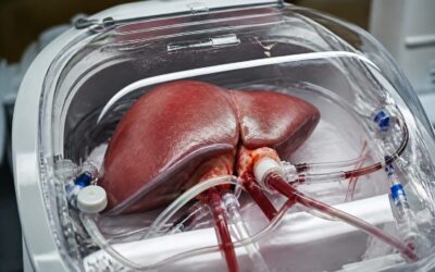 O procedură nouă ar putea aduce încă 150 de transplanturi de ficat pe an în Marea Britanie