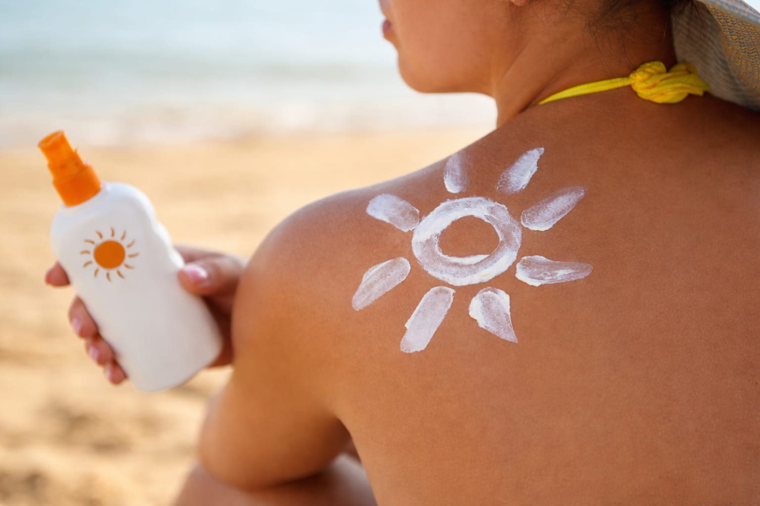 Arsura solară din tinerețe crește riscul de cancer de piele la 60 de ani, avertizează un dermatolog