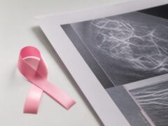 Sydney Towle a murit la 26 de ani după aproape trei ani de luptă cu un cancer rar