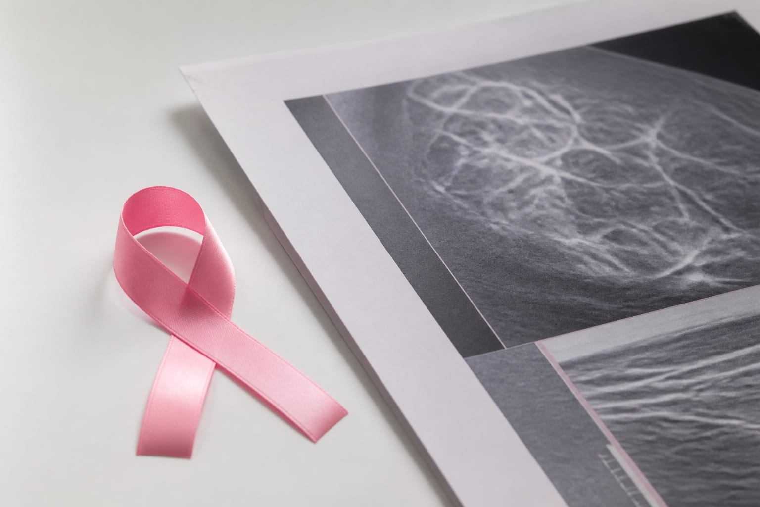 Sydney Towle a murit la 26 de ani după aproape trei ani de luptă cu un cancer rar