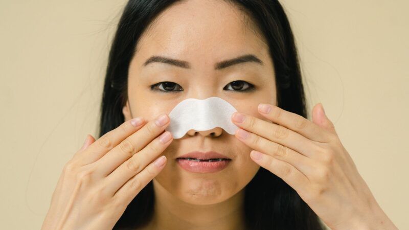 Stoarcerea punctelor negre poate lăsa cicatrici. Ce recomandă dermatologii pentru îndepărtare și prevenție