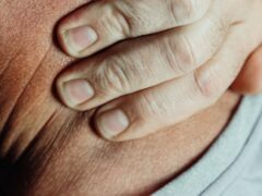 O relație stresantă poate schimba aspectul pielii și al părului. Ce explică specialistele